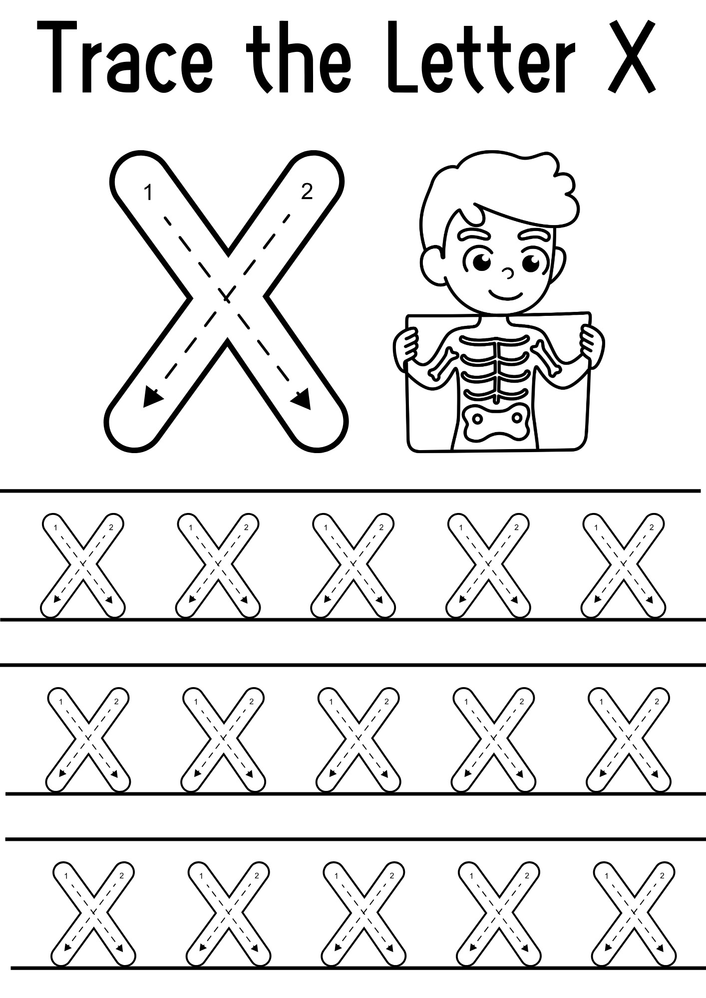 Fun letter X tracing activity book with EYFS alphabet worksheets to support early years handwriting and letter recognition